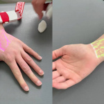 Takto sestričky vidia žily vďaka prístroju | Zdroj: FNTT